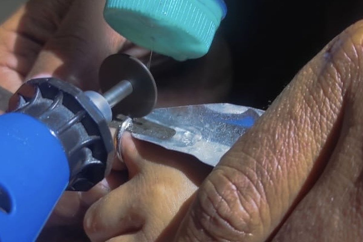 Petugas Damkar saat melepaskan cincin di jari anak, Rabu (16/7/2025).