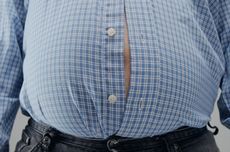 Kenali Penyebab dan Cara Mencegah Obesitas