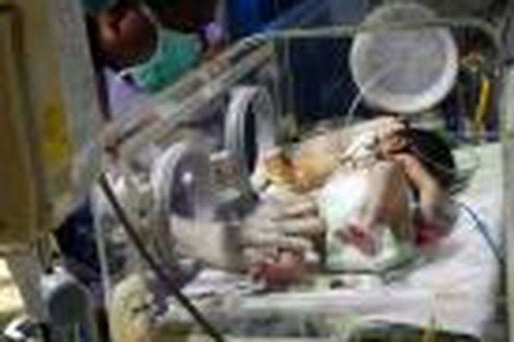 Wakil Gubernur Jawa Barat Deddy Mizwar mengunjungi bayi kembar parasit bernama Ginan Septian Nugraha yang saat ini dirawat di ruang Neonatal Intensive Care Unit (NICU) RSHS Bandung, Minggu (29/9/2013).