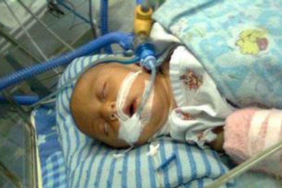 Nesya Winda Azahra, terbaring dengan sejumlah alat bantu dalam perawatan di ruang ICU anak, Rumah Sakit Harapan Kita, Jakarta, sejak pekan lalu. Orang tua si bayi pun mengalami kesulitan dana untuk membiayai operasi putrinya itu.