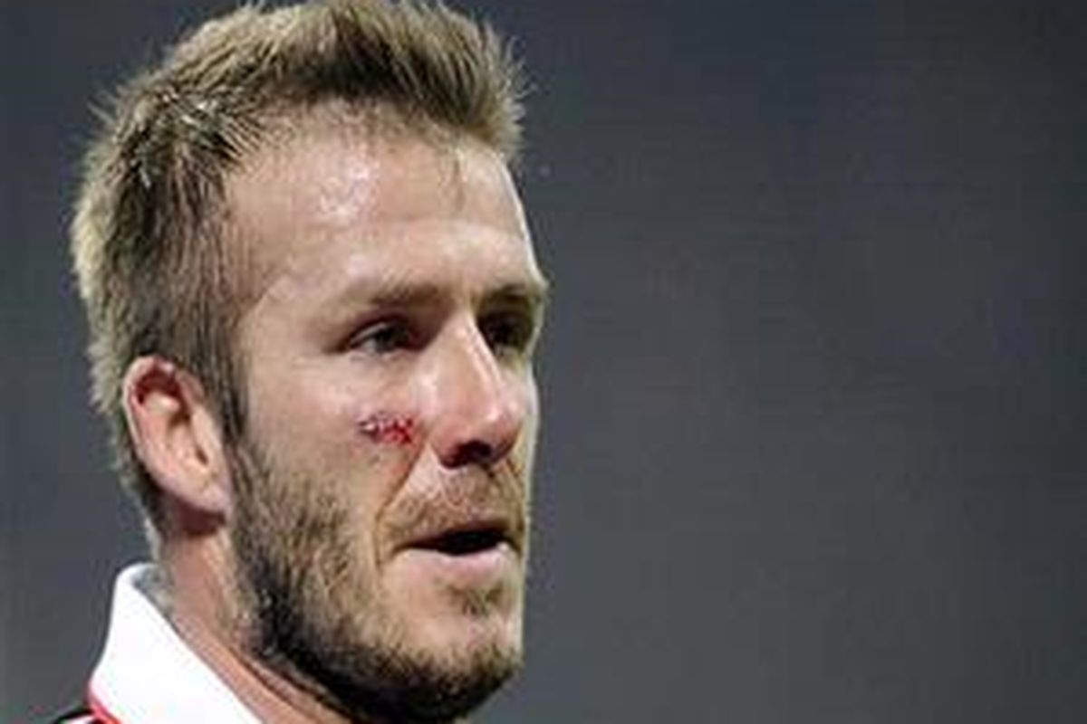 David Beckham.