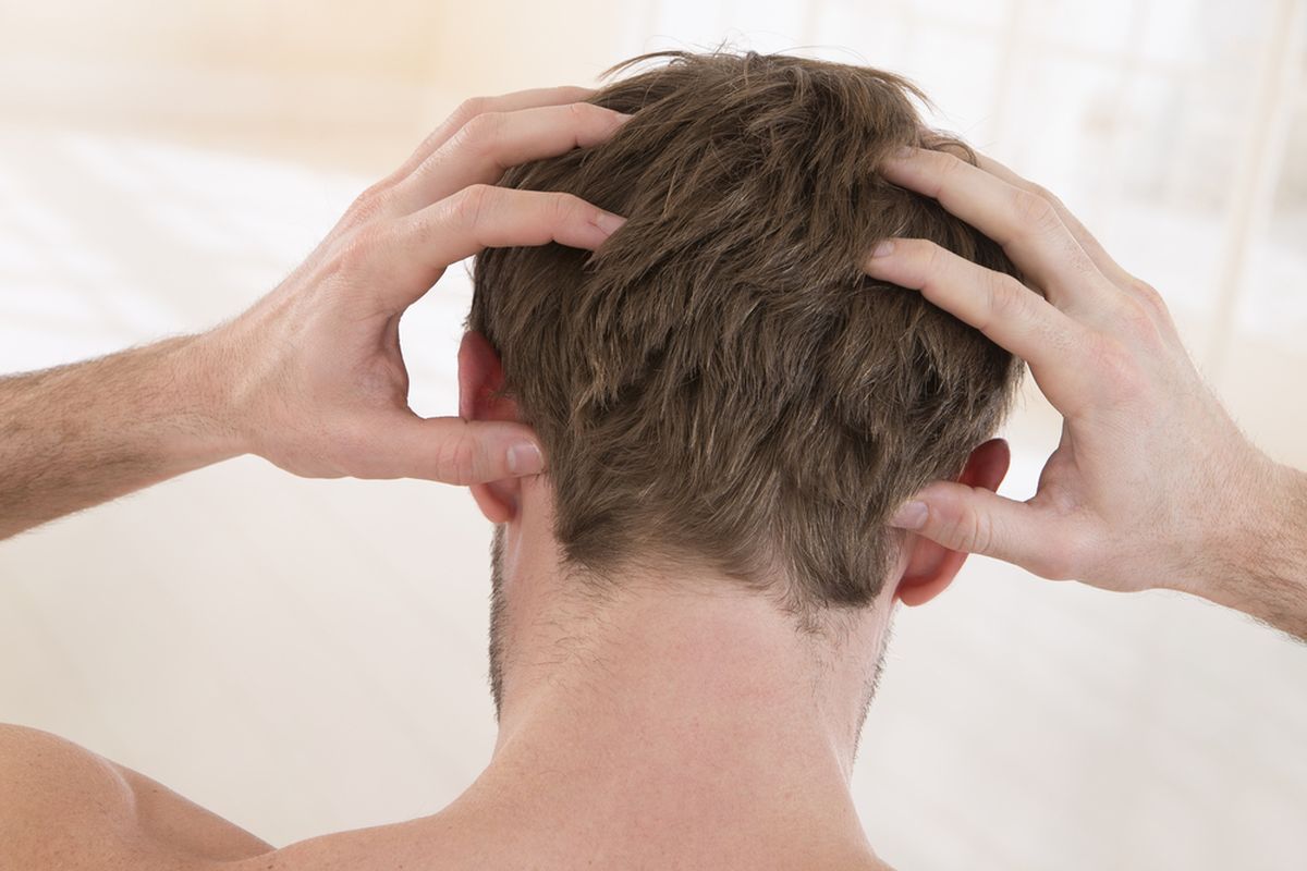Ilustrasi penyebab rambut kering pada pria.