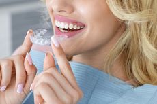 Tren Merapikan Gigi dengan Clear Aligner, Lebih Efektif dari Behel?