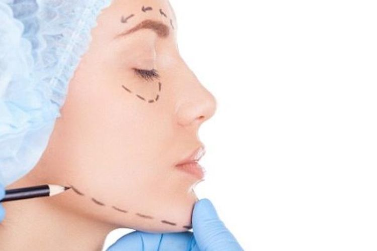 ilustrasi operasi plastik di bagian wajah.