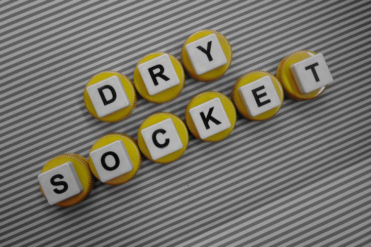 Ilustrasi Dry Socket