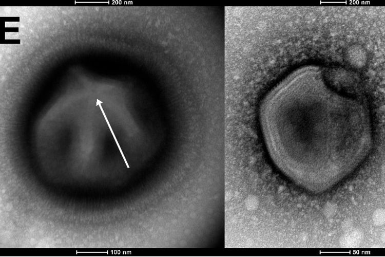 Spesimen virus kuno menginfeksi amoeba. Peneliti menghidupkan kembali virus kuno yang ditemukan di permafrost Siberia.