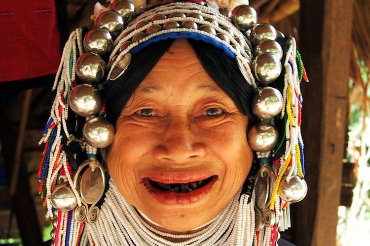Ribuan Tahun Gigi Hitam Dianggap Cantik, Bagaimana Budaya Ini Berubah?