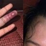 Aniaya Pembelinya, Selebgram Penjual Baju Bekas Jadi Tersangka