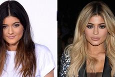 Kris Jenner Tak Pernah Setuju Kylie Jenner Suntik Bibir