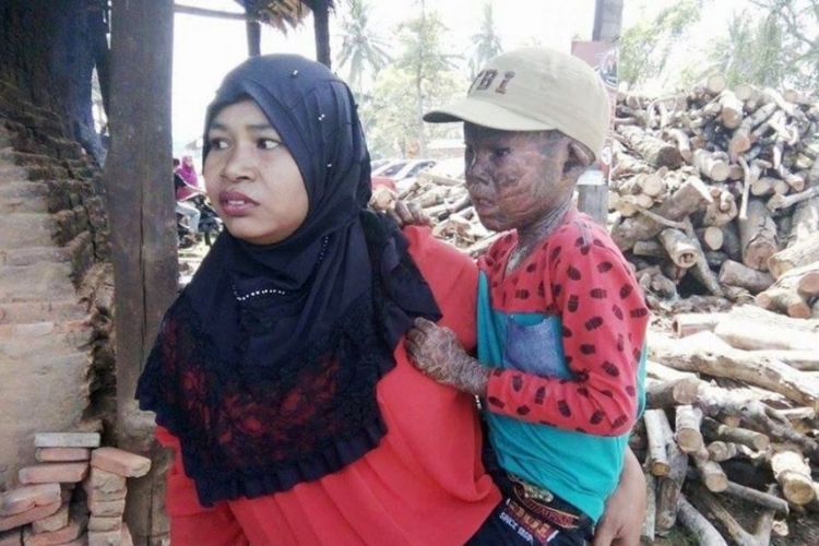 Maulana digendong ibunya di depan rumahnya Desa Lancang Barat, Kecamatan Dewantara, Aceh Utara