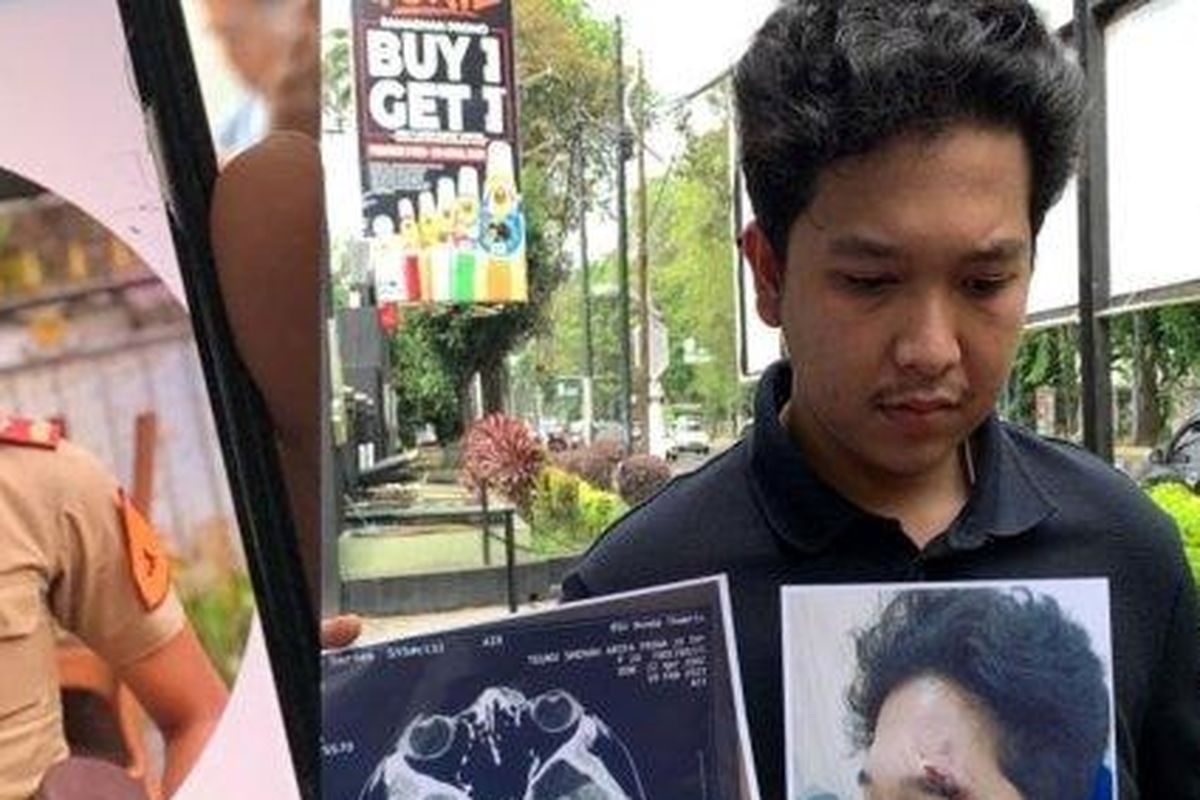 Taruna Akmil diduga menganiaya mahasiswa FK UISU bernama Teuku Shehan Arifa Pasha.

