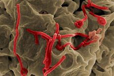 Virus Berbentuk Filamen: Pengertian dan Contohnya