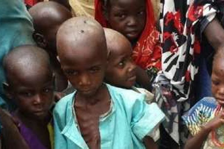 Sebagian anak-anak pengungsi, korban serangan Boko Haram di Bama, Nigeria timur laut, menderita kekurangan gizi akut. Setiap hari 30 orang mati akibat kelaparan dan penyakit di kamp pengungsi tersebut.
