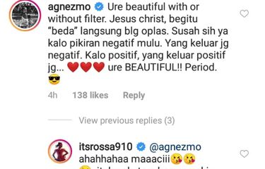 Agnez Mo membela Rossa yang dituding warganet melakukan operasi plastik.
