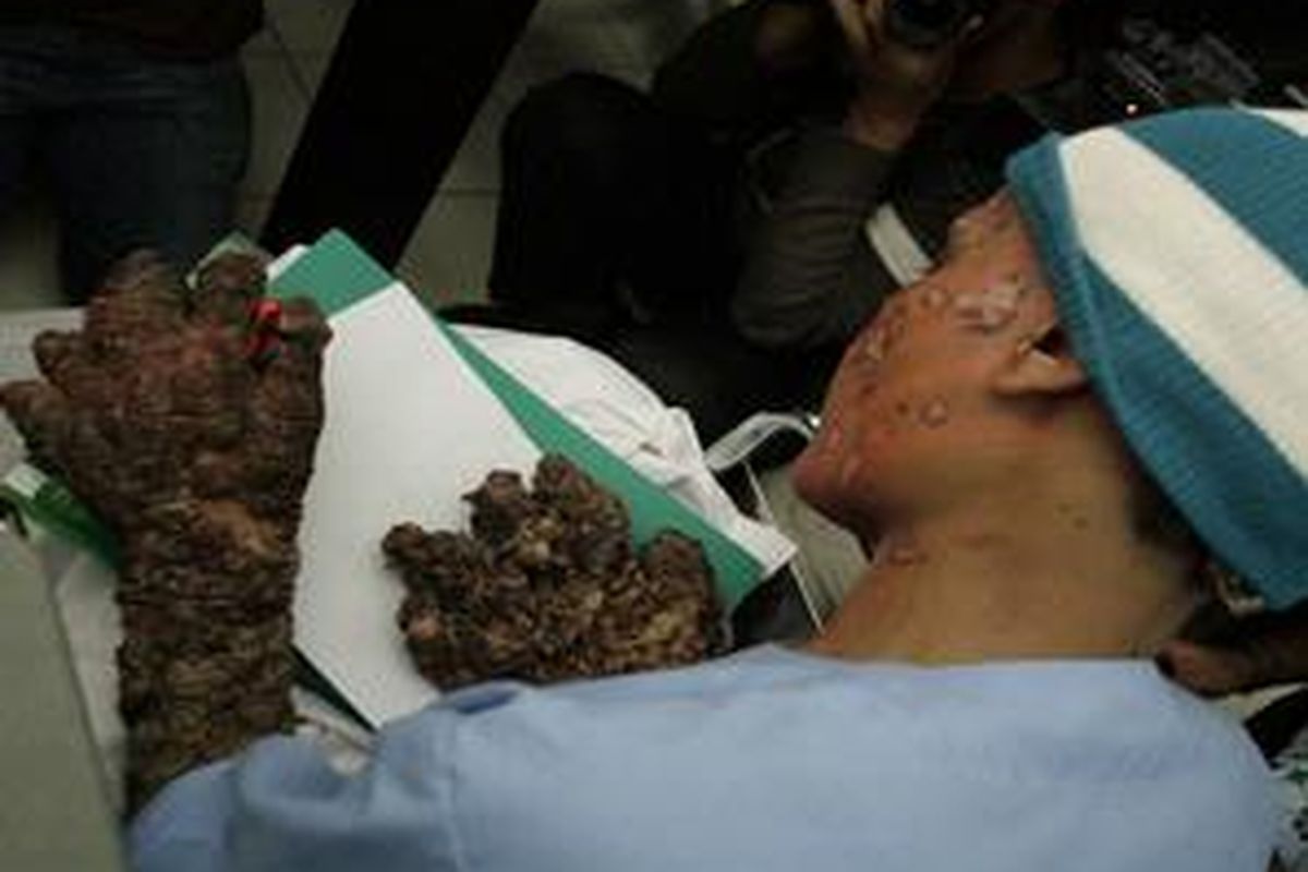 Dede, di antara para wartawan