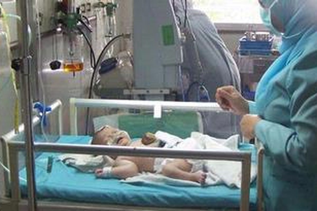 Alful Laili mendapat perawatan intensif di RSUD Dr Soetomo Surabaya. Bayi perempuan yang baru 3 hari ini sejak lahir memiliki kelainan. Jantungnya berada di luar rongga dada.