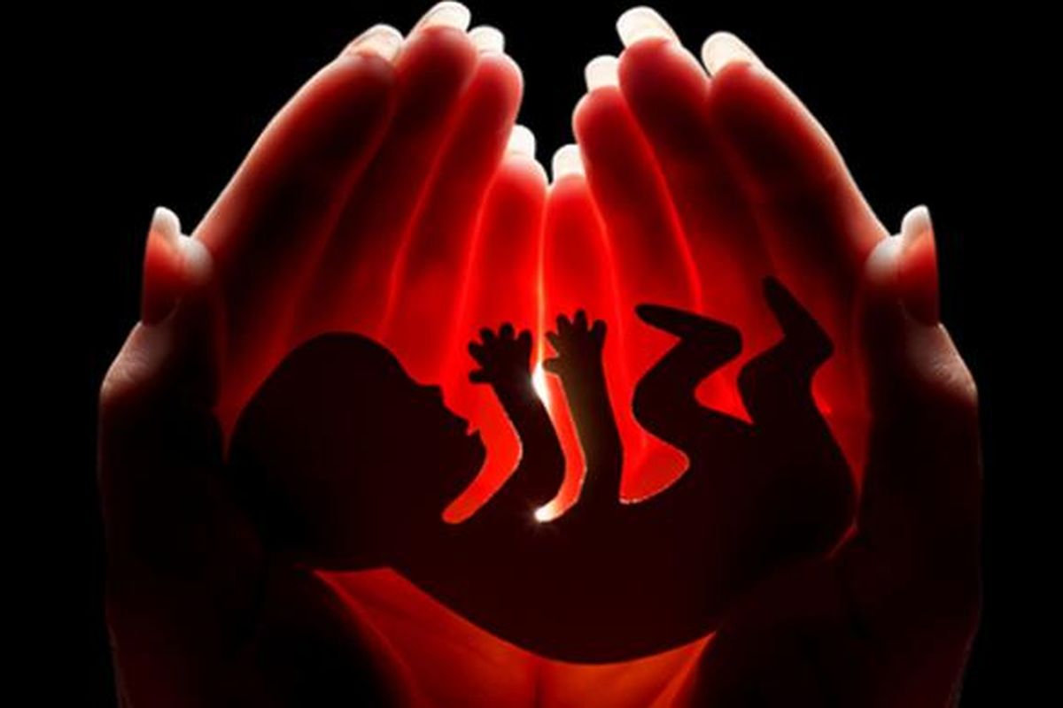 ilustrasi aborsi. Aborsi adalah tindakan medis yang memiliki risiko kesehatan berapapun usia kehamilannya. Semakin tua usia kehamilan, risiko aborsi semakin besar.