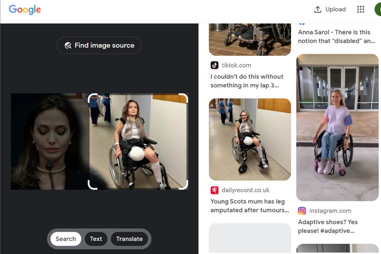 Tangkapan layar pencarian gambar di Google Lens, menampilkan artikel soal seorang perempuan bernama Chantelle Cox (25) yang kaki kanannya diamputasi setelah dokter menemukan tumor di pergelangan kaki dan betisnya.