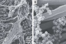 Gambar Virus Corona SARS-CoV-2 Menyelimuti Sel Paru-paru Manusia