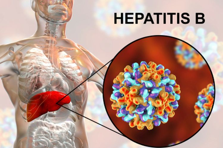 Mengetahui apakah hepatitis B bisa sembuh sangat penting untuk mencegah kondisi yang lebih serius, seperti kanker lever atau hati.