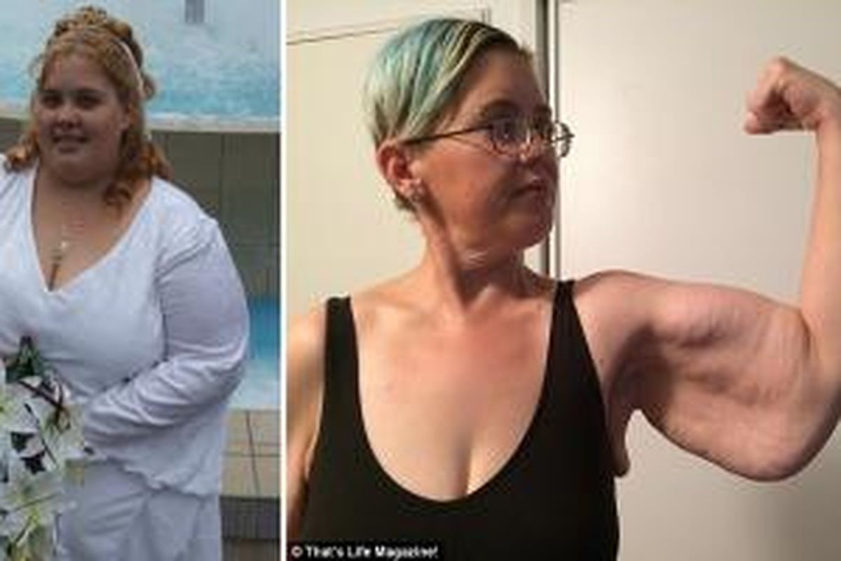 Berat badan dan tubuh Emma Lovell, sebelum dan sesudah turun berat badan lebih kurang 135 kilogram. 