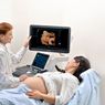 Waspada Risiko Tersembunyi Kehamilan, Deteksi Dini dan Teknologi Monitoring Jadi Kunci Keselamatan Ibu dan Bayi