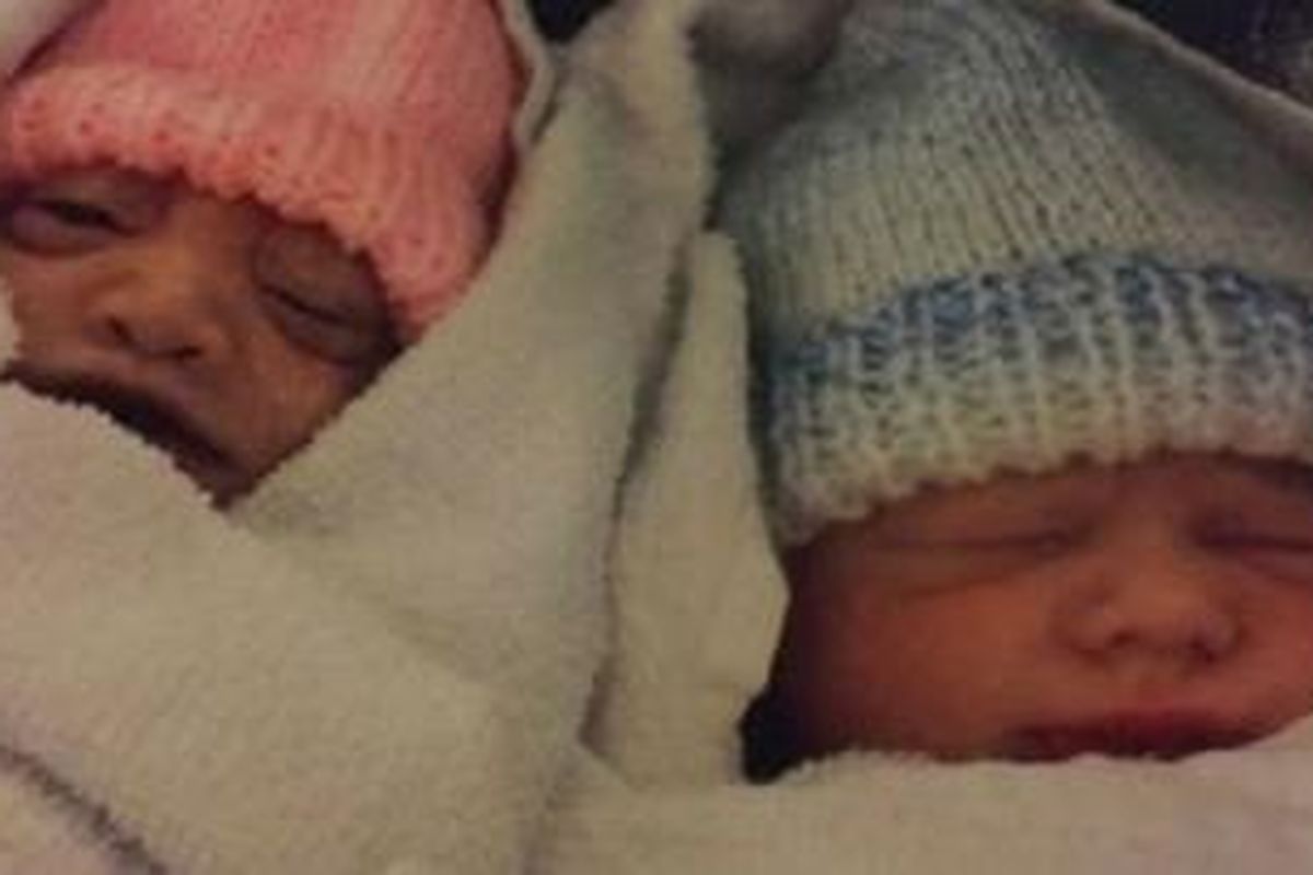Hope Lee (kiri) meninggal 74 menit setelah lahir. Dia meninggalkan saudara kembarnya, Josh.