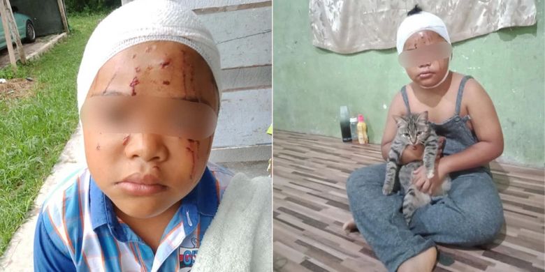Seorang bocah di Malaysia tetap menyanyangi kucing peliharaannya meski mukanya dipenuhi cakaran kucing.