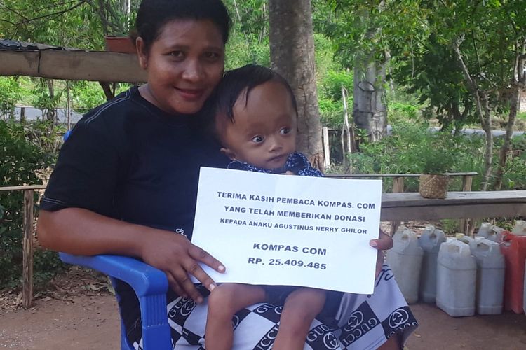 Foto : Agustinus Neri Gilor, bayi berusia 9 bulan asal Desa Mbarungkeli, Kecamatan Riung, Kabupaten Ngada, NTT, idap hidrosefalus sejak lahir mendapat bantuan dana dari pembaca Kompas.com, Sabtu (28/6/2020). 