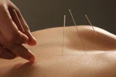 Akupunktur, Cara Tradisional yang Efektif Redakan Nyeri Lutut