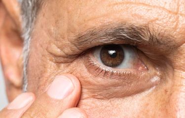 Ilustrasi faktor risiko retinopati diabetik.