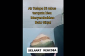 Rebusan Air Kelapa Disebut Dapat Sembuhkan Batu Ginjal, Dokter: Bisanya untuk Mencegah