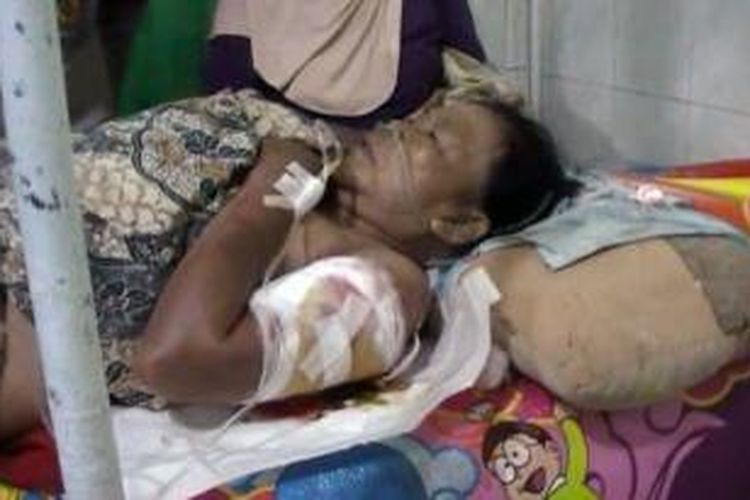 Rupah, korban pembacokan karena dituduh memilik ilmu santet, dirawat di rumah sakit dr. H. Slamet Martodirdjo Pamekasan.