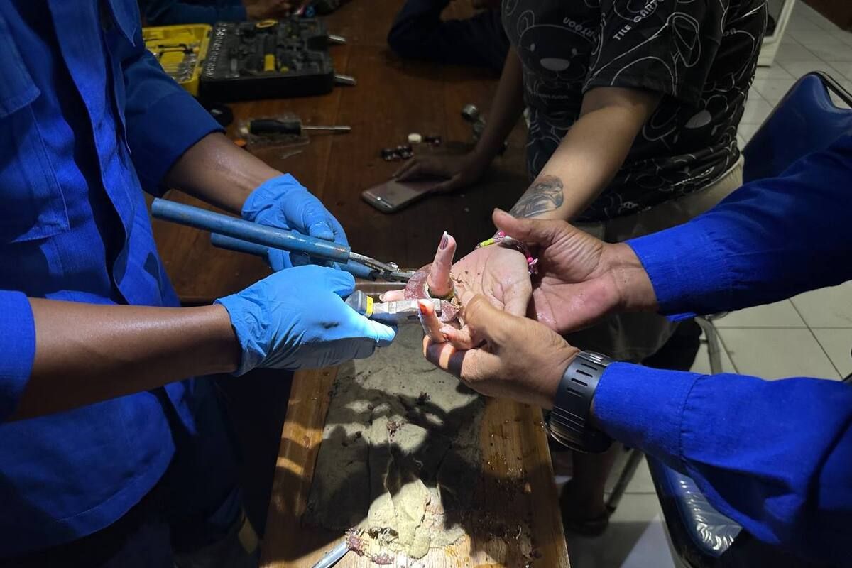 Petugas pemadam kebakaran Trenggalek melakukan evakuasi mara gerinda, yang menyangkut di jari manis seorang warga, Selasa (26/12/2023).