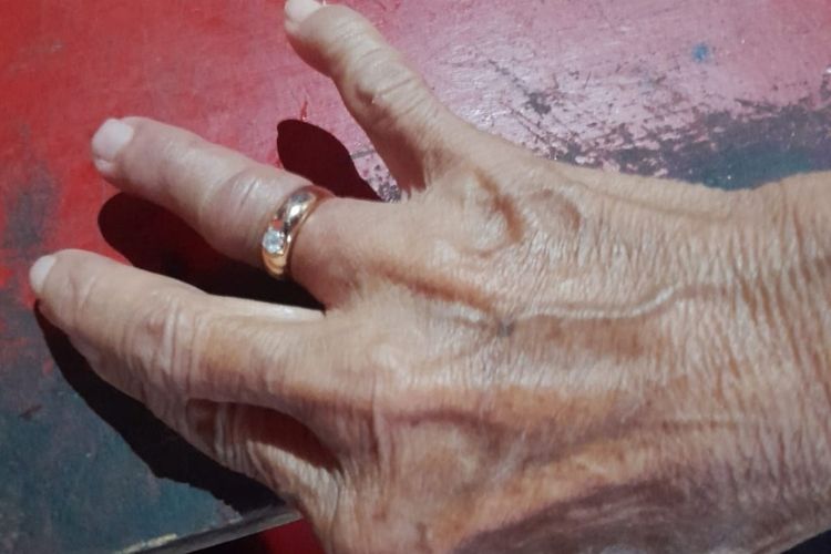 Cincin Menyangkut di Jari, Nenek di Yogya Naik Sepeda Minta Bantuan ke Damkarmat