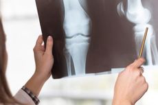 Aplikasi ATOs A Buatan Tim Unair Bisa Deteksi Osteoporosis