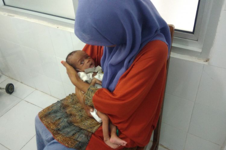 Indri Mutoharoh (38) menggendong Fatimah, anak kedelapannya yang menderita gizi buruk, Kamis (6/7/2017).