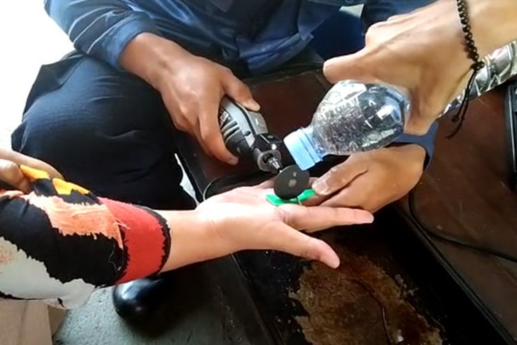 Petugas Pemadam Kebakaran Kabupaten Ciamis sedang memotong cincin di jari tengah korban, Minggu (19/12/2021). Petugas menggunakan mini grinder untuk memotong cincin tersebut.