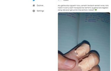 Ramai soal kebiasaan mengopek kuku di jari tangan, normalkah itu?