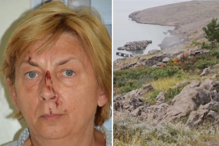 Wanita yang diduga berusia 60 tahun itu ditemukan berlumuran darah dan tidak tahu bagaimana dia sampai ke pulau terpencil itu.
