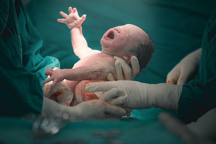 Ilustrasi bayi baru lahir langsung menangis. Pentingnya pemeriksaan saturasi oksigen pada bayi baru lahir untuk mencegah kematian akibat penyakit jantung bawaan (PJB).