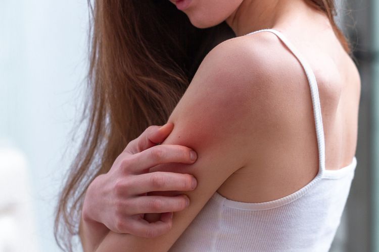 Tipe kulit kering yang berbeda memiliki gejala yang berbeda juga.