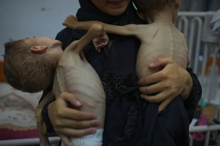 10.000 Lebih Anak Kota Gaza Derita Gizi Buruk Akut di Tengah Perang