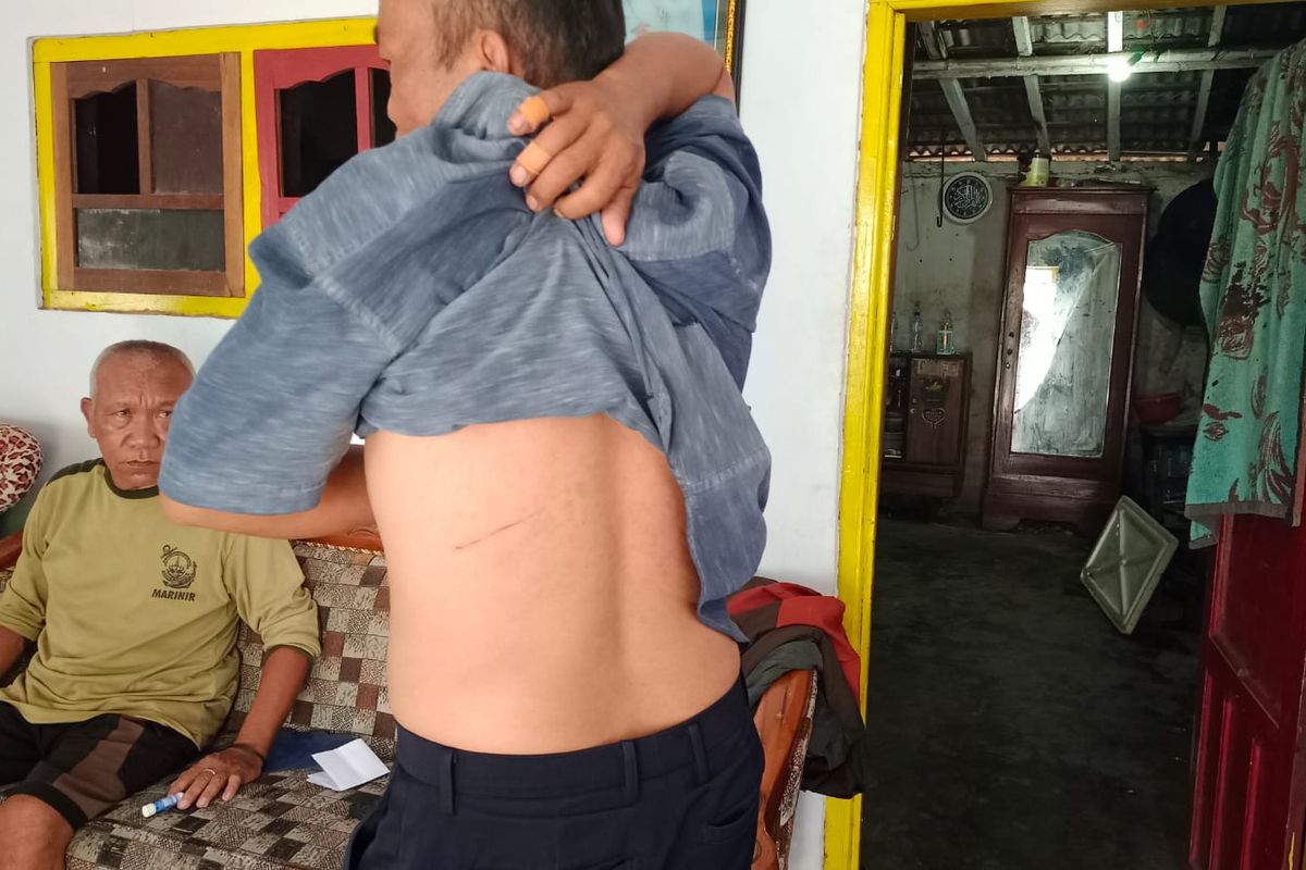 MS (50) warga Curah Jeru, Kecamatan Panji, Kabupaten Situbondo pada Minggu (30/6/2024) memperlihatkan bekas bacokan oleh pelaku.