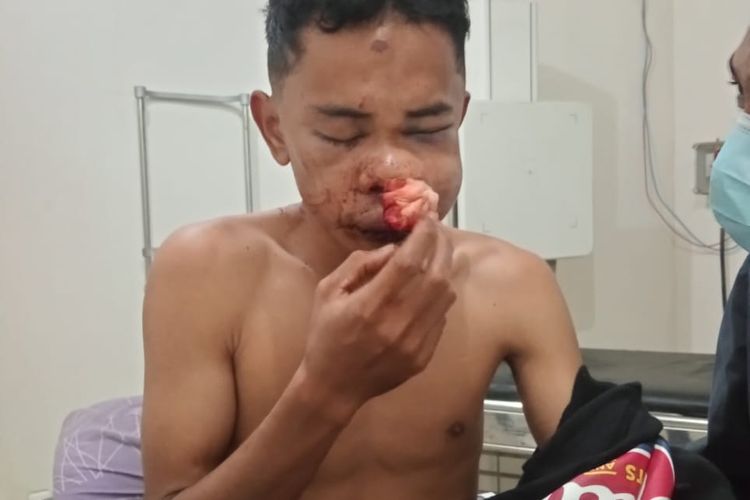 Aniaya Mahasiswa hingga Babak Belur, 4 Anggota Polisi dan 2 Pegawai Harian Lepas di Polres Manggarai Jadi Tersangka