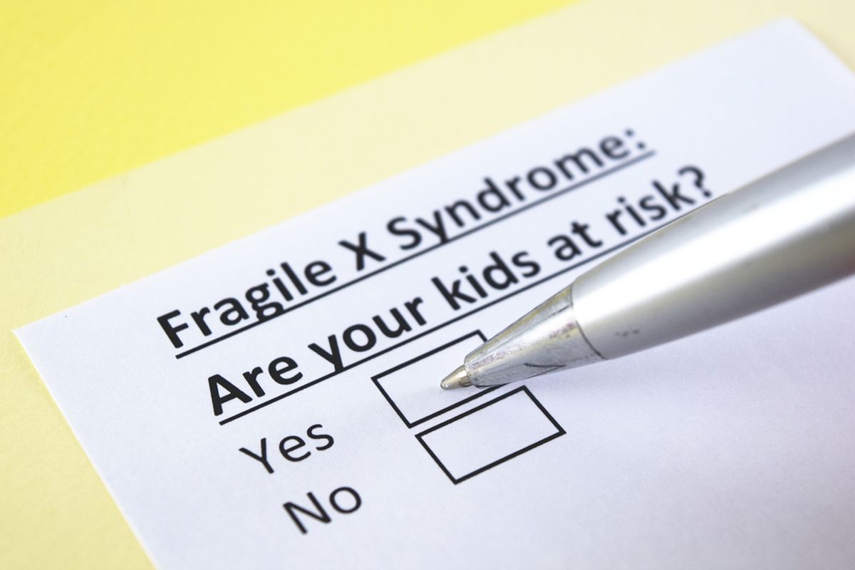 Ilustrasi Fragile X Syndrome