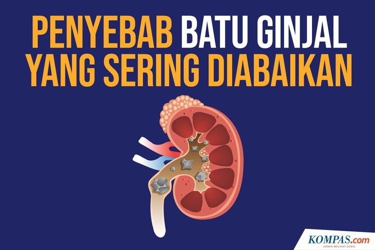 Penyebab batu ginjal yang sering diabaikan