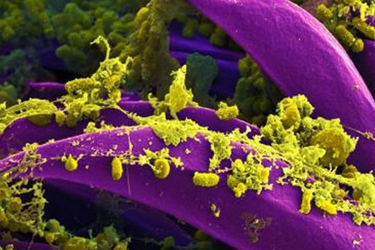 Bakteri Yersinia pestis penyebab penyakit pes (kuning).