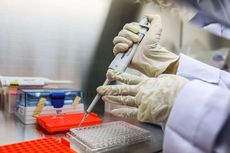 PCR Deteksi Virus Corona Sudah Mati, Mungkinkah Penyebab Hasil Tes Bisa Positif Palsu?