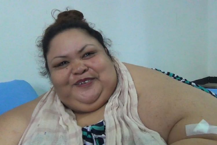 Wajah Titin, penderita obesitas 300 kg, terlihat mulai bisa tersenyum saat sudah berada diruang rawat inap rumah sakit di Palangkaraya, Jumat (11/1/2019). 
